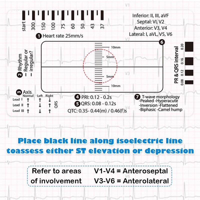 7-Step ECG Ruler, Transparent EKG Measuring Tool, Pocket-Sized 8.6cm x