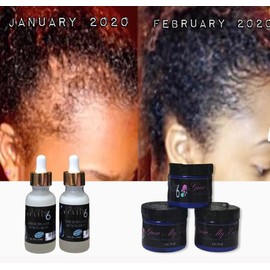 Biotin Hair Growth Oil Scalp Drops- Comfort for the Scalp -Stimulating Haircare