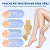 30pz Parches Antimicóticos For El Tratamiento De Uñas