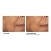 Suero De Biopéptido De Niacinamida; Nassifmd Skincare