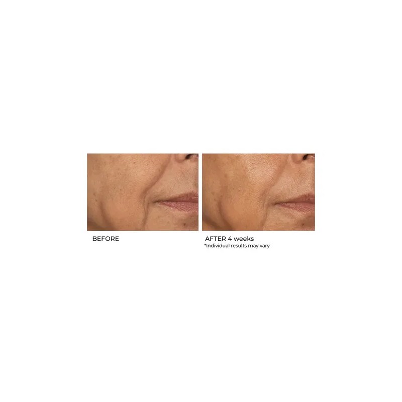 Suero De Biopéptido De Niacinamida; Nassifmd Skincare