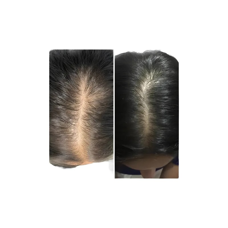 Shampoo Vandé Capilar Caballo Y Biotina 20 L.
