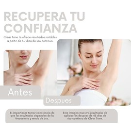 Clear Tone Crema Despigmentante 50g - Manchas Solares, Edad y Hormonales - Con Retinol, Vitamina E, Árbol de Té y Caléndula - Para Axilas, Codos, Rodi