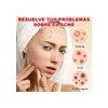 180pzs Parches Pegatinas Para Acné Absorbentes Pimple Patch