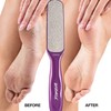 Probelle Double Sided Multidirectional Nickel Foot File Callus Remover -