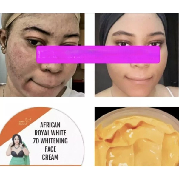 Unbranded FACE LIGHTENING CREAM