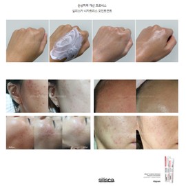 Silisca Cicatrice Ointment Moisturizing Skin Protection Calming Cream 40g+SM-M1 Pouch Set / 실리스카 시카트리스 오인트먼트 보습 피부보호 진정 크림 40g+SM-M1파우치세트