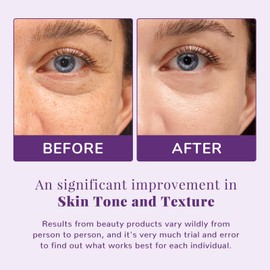 ANAI RUI Niacinamide Toner Pads,with Glutathione, Niacinamide, LHA, PHA, Facial Radiance Wipes for Even Skin Tone, Reduce Blemish and Spots 50 Pads