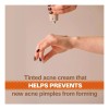 Acnomel Crema Para Adultos Acne 36gr 1.3oz