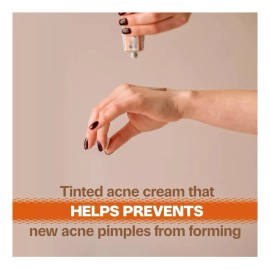 Acnomel Crema Para Adultos Acne 36gr 1.3oz