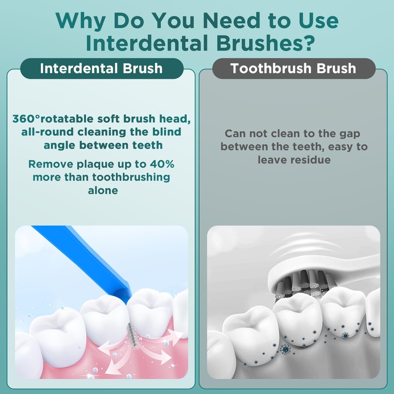 Fremouth Angle Interdental Brushes for Braces, Tight(0.7mm), L- Shaped Interproximal