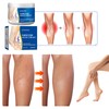 2 Pcs Varicose Veins Cream for Legs, Spider Varicose Veins