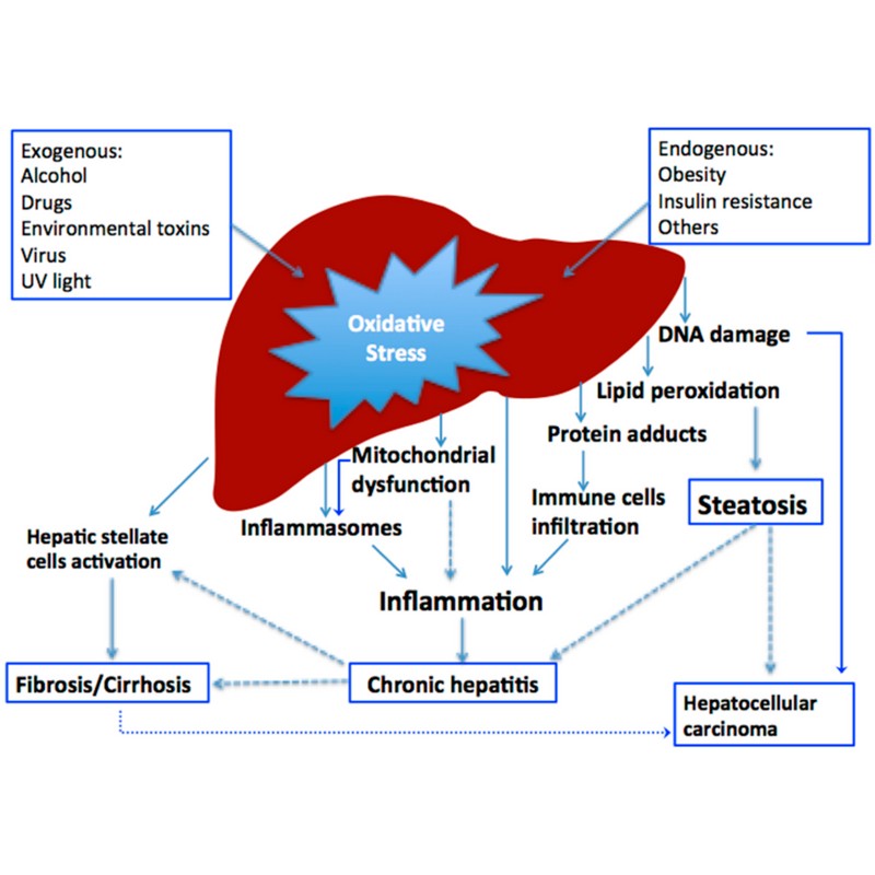 E-HETE Liver Care, Protects Liver from Stress-Induced Damage, Body's Detoxification