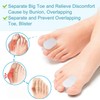 Skeerthy 5 Pairs Toe Separators Hammer Toe Straightener Bunion Cushion,