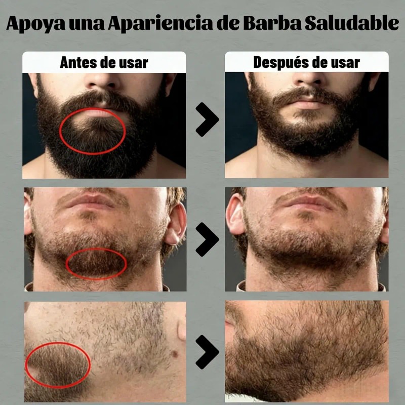 Mopoyat Tratamiento Barba Bigote Estimula Crecimiento Lavanda
