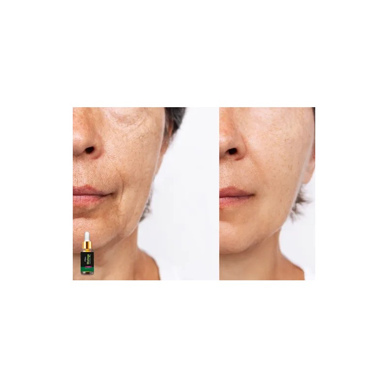 Crema + Aceite De Moringa Antiarrugas Antimanchas Antiedad