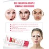 Aichun Beauty Bikini Días Crema Corporal Axilas