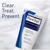 PanOxyl Acne Foaming Wash 10% Benzoyl Peroxide 5.5 oz (156