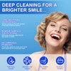 9D Teeth Whitening Strips 14 Treatments, Enamel Safe, Whitening Teeth