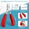 Toenail Clippers for Thick Nails, Pedicure Set Nail Clippers for