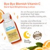 Bye Bye Blemish Dark Spot Lotion Vitamina C, 1 onza