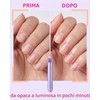 UEAVOID Penna Rimuovi Cuticole Unghie 3-n-1, 1 pz con Punta