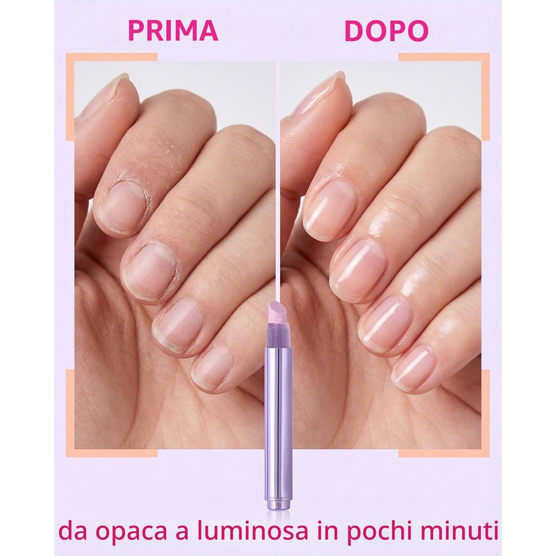 UEAVOID Penna Rimuovi Cuticole Unghie 3-n-1, 1 pz con Punta