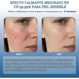 Toallas Faciales Desechables Secas Extra Grandes (Rostro Limpio y Sin Bacterias), Limpieza Facial Diaria, Toallas para la Cara, Toallitas Desmaquillantes, 50 Toallitas (2 Paquetes)