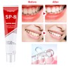 Fengyang® SP-8 Ultra Whitening Toothpaste, Probiotic Whitening Tooth-Paste, Probiotics Bright