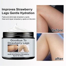 Strawberry Legs Treatment Cream For Women, Skin Smoothing Cream for Chicken Skin Treatment, Smooth Radiant Skin Care Solution,Exfoliating, Moisturizing