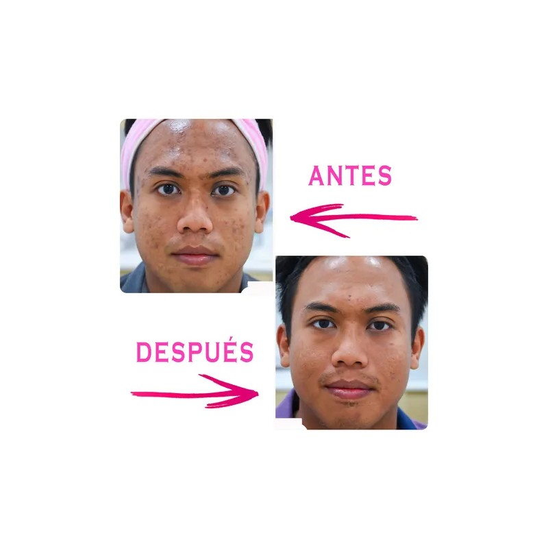 Crema Facial Concha Nacar + Jabón Leche De Burra, Aclarante