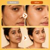 4Pcs Turmeric Skin Care Set- Soap Bar, Facial Cleanser, Toner