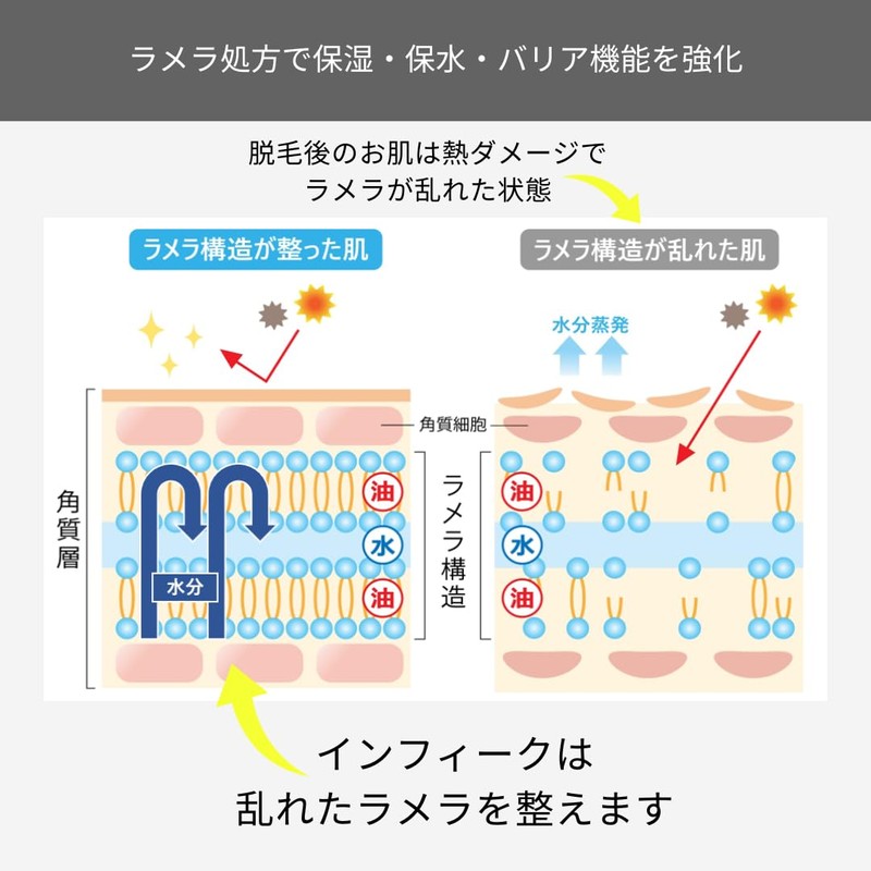 infique lamella lotion