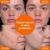 Vitamin C Facial Serum: Dark Spots, Wrinkles, Uneven Tone &