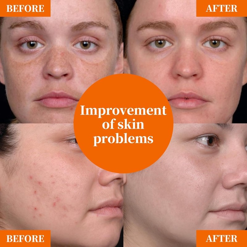 Vitamin C Facial Serum: Dark Spots, Wrinkles, Uneven Tone &