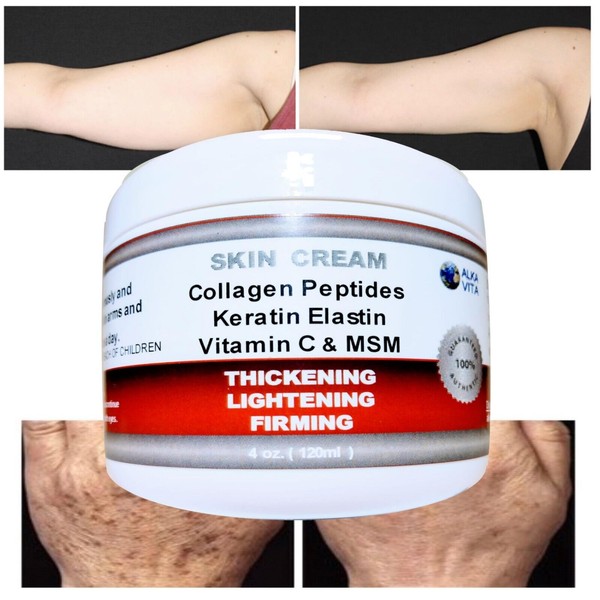 Saggy Arms Skin Firming Wrinkled Neck Cream Collagen Keratin Elastin By ALKAVITA