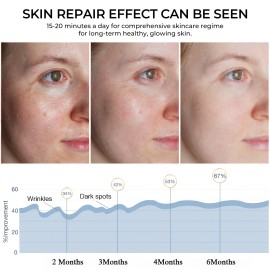 7 Colors Photon Face LED Mask Red Light Therapy for Facial Skin Care Anti-aging