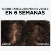 L'Oréal Paris Sérum capilar anti quiebre con 1.5% Aminexil Elvive