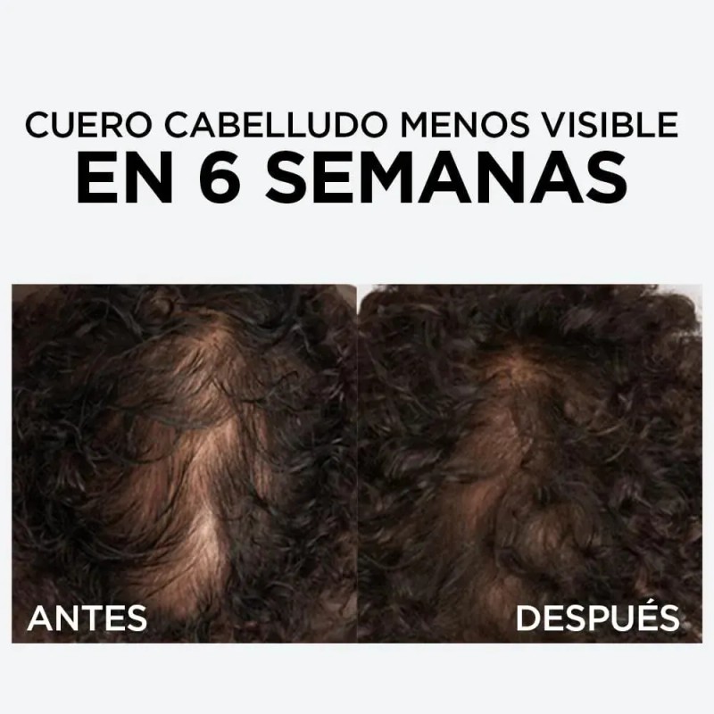 L'Oréal Paris Sérum capilar anti quiebre con 1.5% Aminexil Elvive