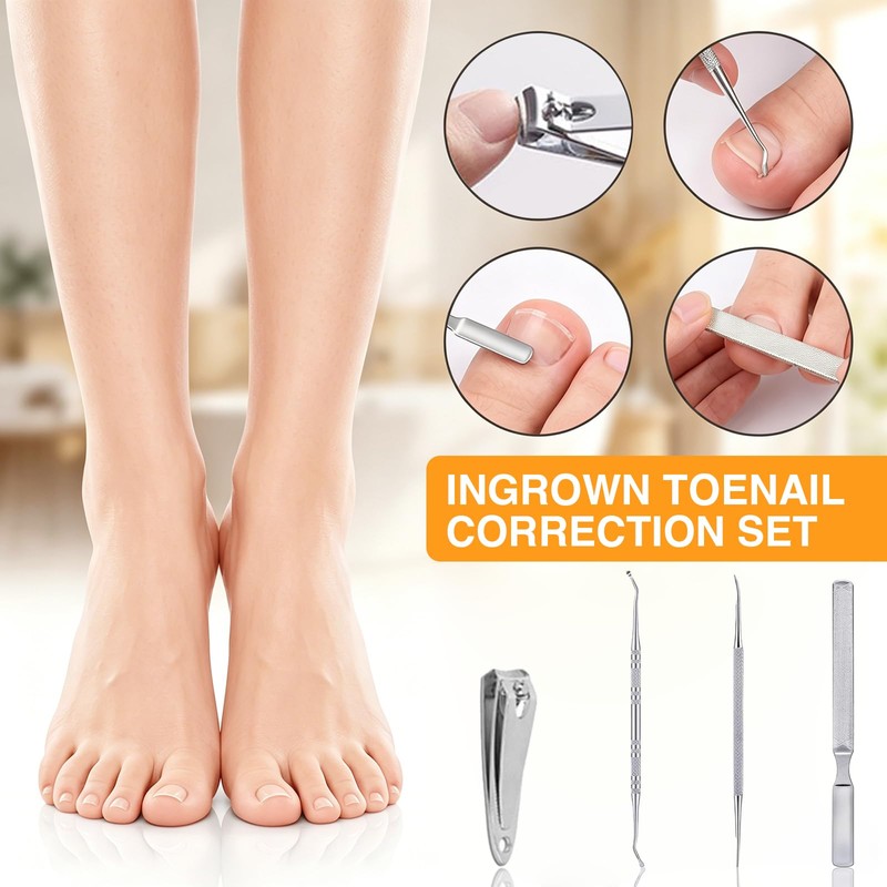 Benaewa 118 Pcs Ingrown Toenail Treatment Kit, Includes Ingrown Toenail