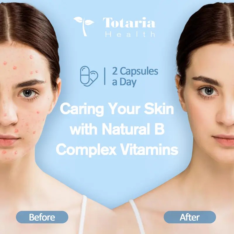 Totaria 13-in-1 Vitamin B Complex Plus – B1–B12, C, D3,