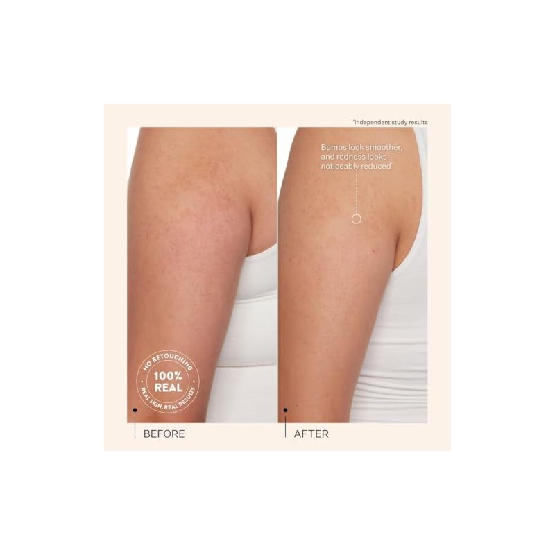 Peach & Lily- Loci?n Corporal Suavizante Kp Bump Boss