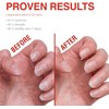 Probelle Tratamiento Fortalecedor de Uñas - Crecimiento y Acondicionamiento