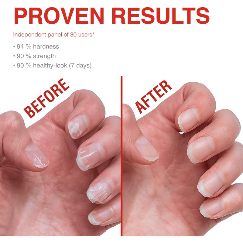Probelle Tratamiento Fortalecedor de Uñas - Crecimiento y Acondicionamiento