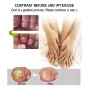 1pzs Crema Natural Hongos Uñas Pies Efero Gel Reparador 20ml