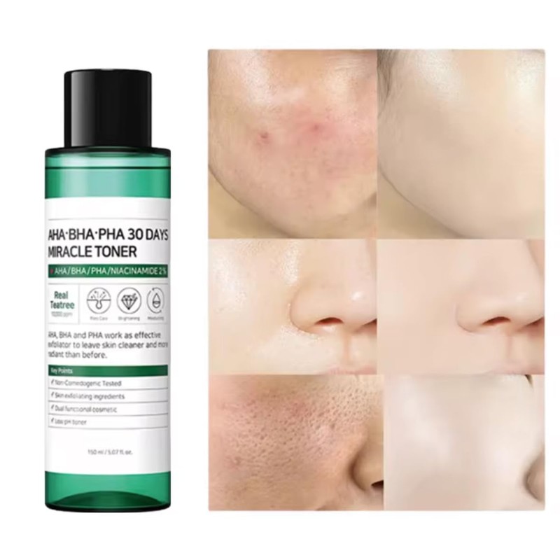Some AHA BHA PHA 30 Days Miracle, 150ml pH 5.5