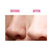 Ultrasonic Face Massager EMS Electric Facial Cleanser Heating Skin Care