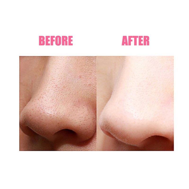 Ultrasonic Face Massager EMS Electric Facial Cleanser Heating Skin Care