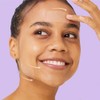 Avarelle Parche para cubierta de acné (16 unidades) para manchas,