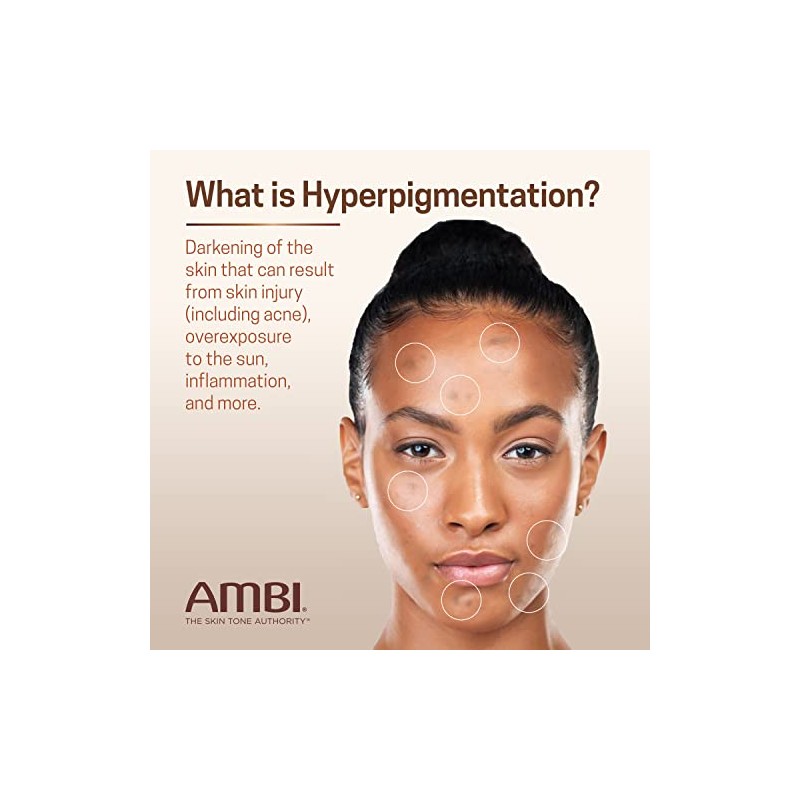 Ambi Even Clear Advanced Fade Cream, Hydroquinone-free, Hyperpigmentation Treatment, Stubborn